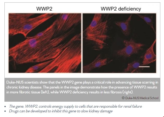 NUS發(fā)現(xiàn)阻止慢性腎病新方法.png NUS發(fā)現(xiàn)阻止慢性腎病新方法.png